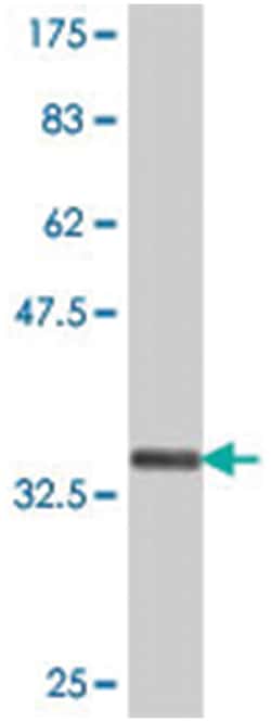 ABCD1, Mouse, Polyclonal Antibody, Abnova 50&mu;L; Unlabeled:Antibodies,