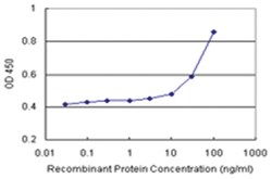 anti-ALDH1A1 Matched Antibody Pair, Abnova