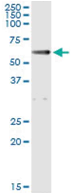 ALDH1A1, Human, IP-WB Antibody Pair (PW2), Abnova 1 Set:Antibodies, Monoclonal/Polyclonal