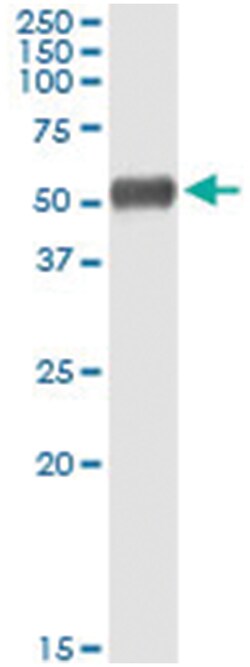 ALDH1A1, Human, IP-WB Antibody Pair (PW3), Abnova&trade;