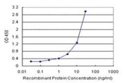anti-ALDH3A1 Matched Antibody Pair, Abnova