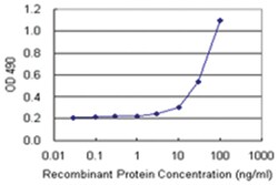 anti-ALDH3A1 Matched Antibody Pair, Abnova&trade;