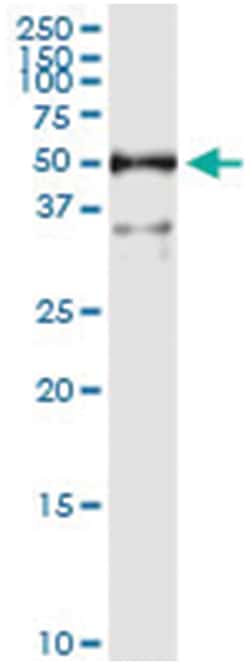 ALDH3A1, Human, IP-WB Antibody Pair (PW1), Abnova&trade;