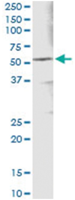 ALDH3A1, Human, IP-WB Antibody Pair (PW2), Abnova&trade;