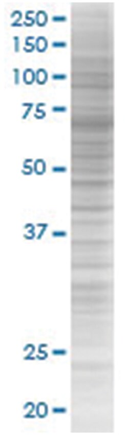 ALPL 293T Cell Overexpression Lysate (Denatured), Abnova 100 &mu;L | Buy Online | Abnova | Fisher Scientific