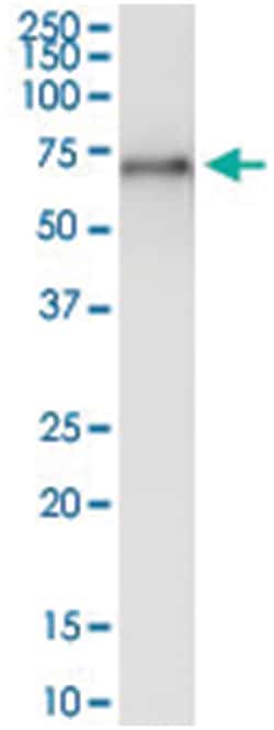 anti-ALPP, Human, IP-WB Antibody Pair, Abnova 1 Set:Antibodies, Monoclonal/Polyclonal