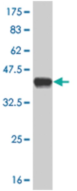ALPPL2, Mouse, Polyclonal Antibody, Abnova 50 &mu;L | Buy Online | Abnova Corporation | Fisher Scientific