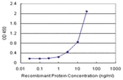 anti-AMBP Matched Antibody Pair, Ab-1, Abnova