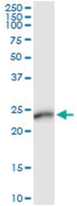anti-AMELX, Human, IP-WB Antibody Pair, Abnova&trade;