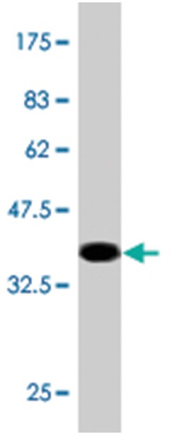 AMFR, Mouse, Clone: 3D9, Abnova 100 &mu;g | Buy Online | Abnova Corporation | Fisher Scientific