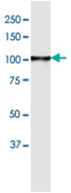 anti-AMPD2, Human, IP-WB Antibody Pair, Abnova 1 Set:Antibodies, Monoclonal/Polyclonal