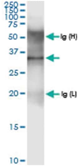 anti-AMT, Human, IP-WB Antibody Pair, Abnova™