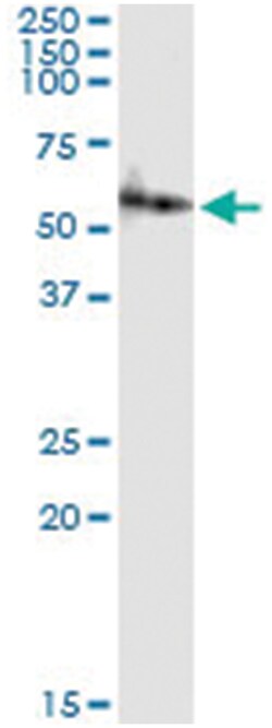 anti-AMY2A, Human, IP-WB Antibody Pair, Abnova™