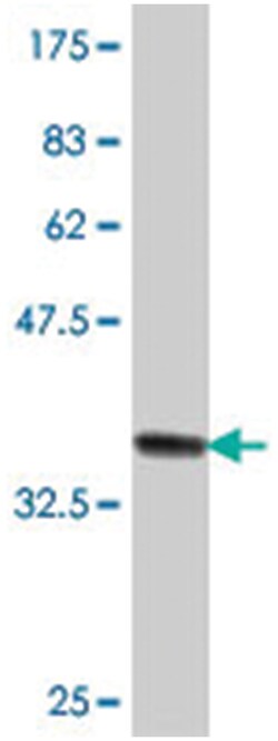AMY2B, Mouse, Polyclonal Antibody, Abnova 50 &mu;L | Buy Online | Abnova | Fisher Scientific