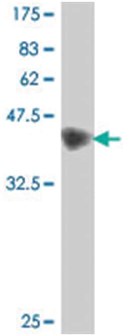 ANK1, Mouse, Polyclonal Antibody, Abnova 50&mu;L; Unlabeled:Antibodies,