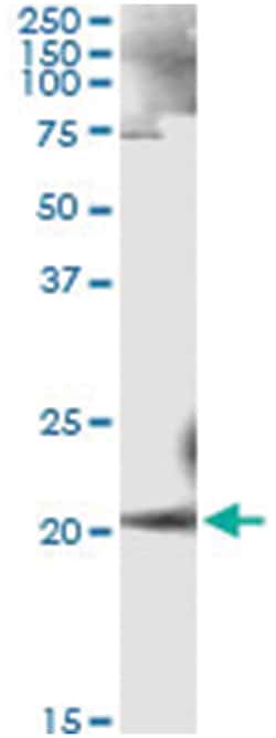 anti-ANK1, Human, IP-WB Antibody Pair, Abnova 1 Set:Antibodies, Monoclonal/Polyclonal