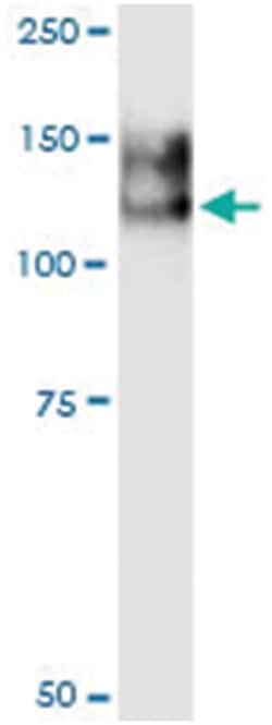 anti-ANPEP, Human, IP-WB Antibody Pair, Abnova 1 Set:Antibodies, Monoclonal/Polyclonal