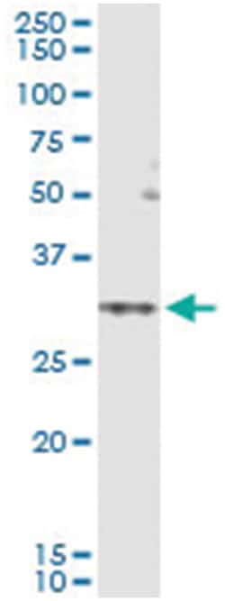 anti-SLC25A5, Human, IP-WB Antibody Pair, Abnova 1 Set:Antibodies, Monoclonal/Polyclonal