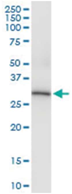 anti-ANXA4, Human, IP-WB Antibody Pair, Abnova 1 Set:Antibodies, Monoclonal/Polyclonal