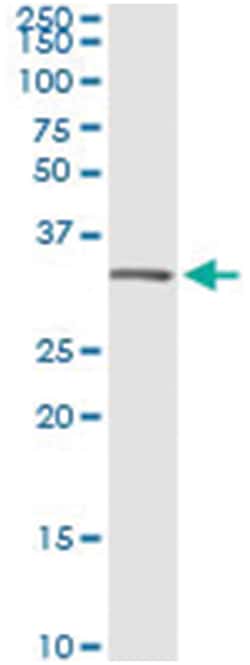ANXA5, Human, IP-WB Antibody Pair (PW2), Abnova&trade;