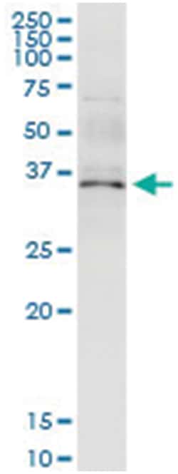 ANXA5, Human, IP-WB Antibody Pair (PW3), Abnova 1 Set:Antibodies, Monoclonal/Polyclonal