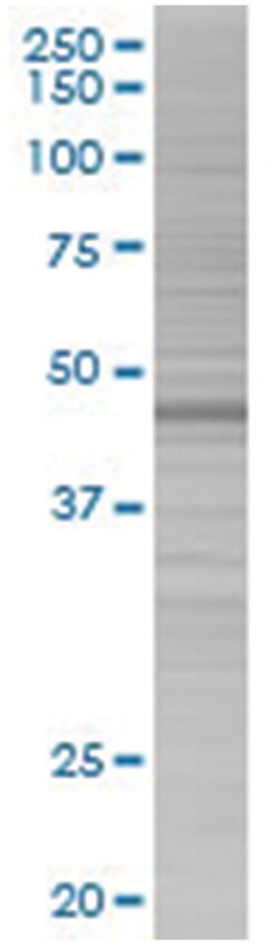 ANXA7 293T Cell Overexpression Lysate (Denatured), Abnova 100 &mu;l | Buy Online | Abnova | Fisher Scientific