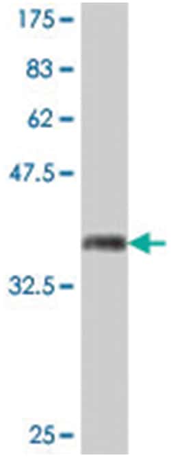 ANXA11, Mouse, Polyclonal Antibody, Abnova 50&mu;L; Unlabeled:Antibodies,