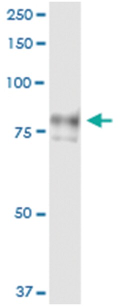 anti-AOC2, Human, IP-WB Antibody Pair, Abnova&trade;