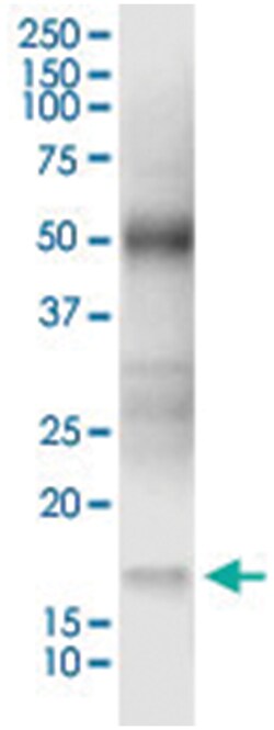 anti-NUDT2, Human, IP-WB Antibody Pair, Abnova™