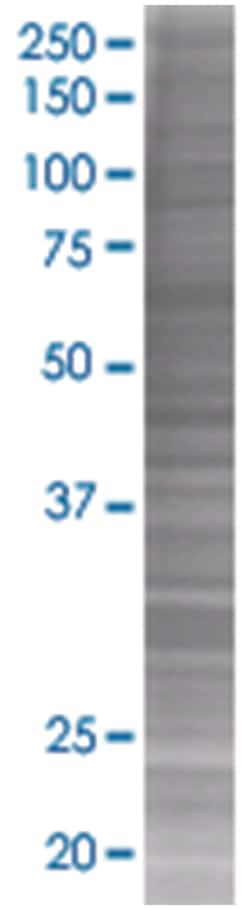 NUDT2 293T Cell Overexpression Lysate (Denatured), Abnova
