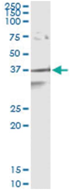 APEX1, Human, IP-WB Antibody Pair (PW2), Abnova 1 Set:Antibodies, Monoclonal/Polyclonal