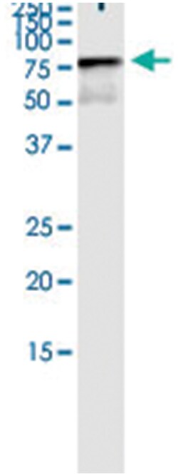 anti-BIRC3, Human, IP-WB Antibody Pair, Abnova&trade;