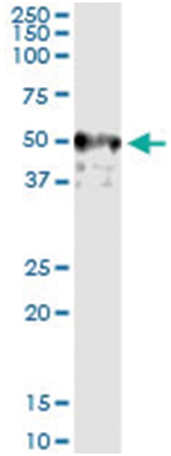 anti-XIAP, Human, IP-WB Antibody Pair, Abnova™