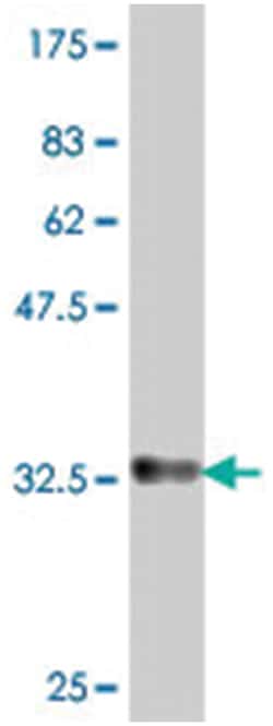 APOC2, Mouse, Polyclonal Antibody, Abnova 50&mu;L; Unlabeled:Antibodies,