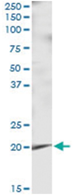 anti-APRT, Human, IP-WB Antibody Pair, Abnova 1 Set:Antibodies, Monoclonal/Polyclonal