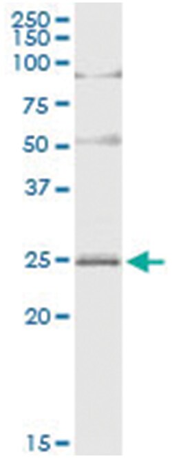 anti-ARL4D, Human, IP-WB Antibody Pair, Abnova™
