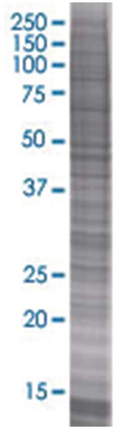 ARG1 293T Cell Overexpression Lysate 1(Denatured), Abnova 100 &mu;L | Buy Online | Abnova | Fisher Scientific