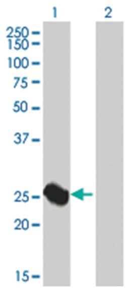 ARG1 293T Cell Overexpression Lysate 1(Denatured), Abnova 100 &mu;L | Buy Online | Abnova | Fisher Scientific