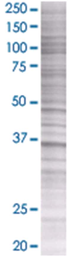 ARG1 293T Cell Overexpression Lysate 2 (Denatured), Abnova