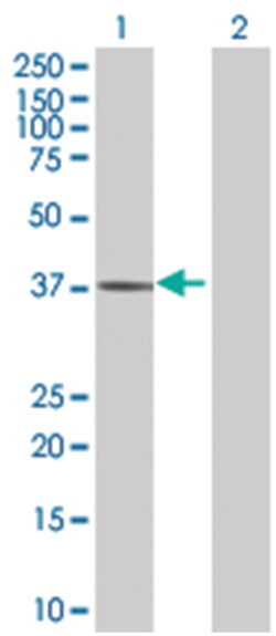 ARG1 293T Cell Overexpression Lysate 2 (Denatured), Abnova