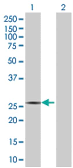 RND3 293T Cell Overexpression Lysate (Denatured), Abnova