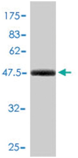 ARHGDIA, Mouse, Polyclonal Antibody, Abnova 50 &mu;L | Buy Online | Abnova | Fisher Scientific
