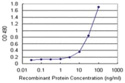 anti-ARHGDIA Ab-2 Matched Antibody Pair, Abnova™