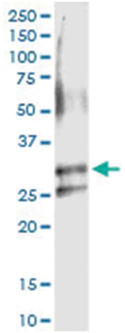 ARHGDIA, Human, IP-WB Antibody Pair (PW1), Abnova 1 Set:Antibodies, Monoclonal/Polyclonal