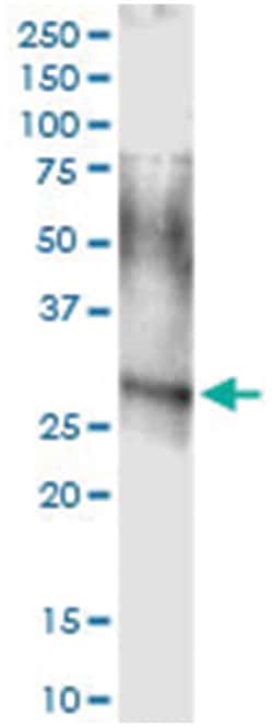 ARHGDIA, Human, IP-WB Antibody Pair (PW2), Abnova 1 Set:Antibodies, Monoclonal/Polyclonal