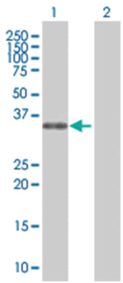 PHOX2A 293T Cell Overexpression Lysate (Denatured), Abnova 100 &mu;L | Buy Online | Abnova | Fisher Scientific