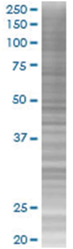 ARNT 293T Cell Overexpression Lysate (Denatured), Abnova