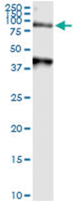 anti-ARSA, Human, IP-WB Antibody Pair, Abnova™