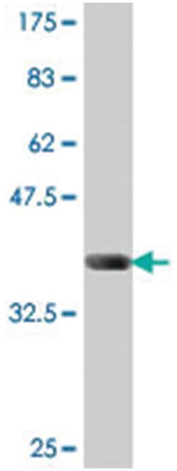 ARSB, Mouse, Polyclonal Antibody, Abnova 50&mu;L; Unlabeled:Antibodies,