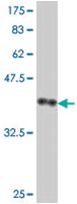 STS, Mouse, Polyclonal Antibody, Abnova 50&mu;L; Unlabeled:Antibodies,